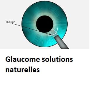 Glaucome solutions naturelles