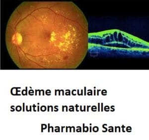 Œdème maculaire solutions naturelles
