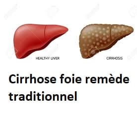 Cirrhose foie remède traditionnel