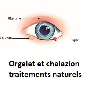 Orgelet et chalazion traitements naturels
