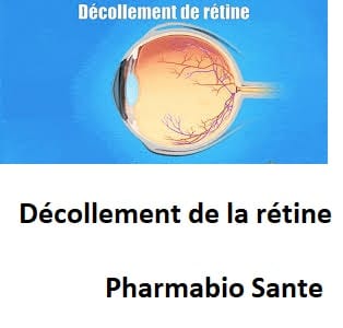 Décollement de la rétine soins naturels