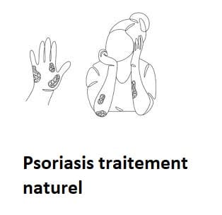 Psoriasis traitement naturel