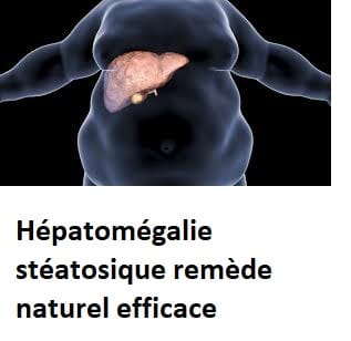 Hépatomégalie stéatosique remède naturel efficace