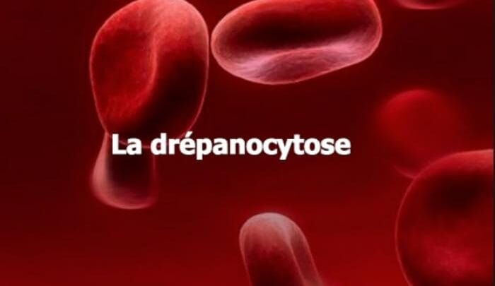 Traitement Naturel de la Drépanocytose
