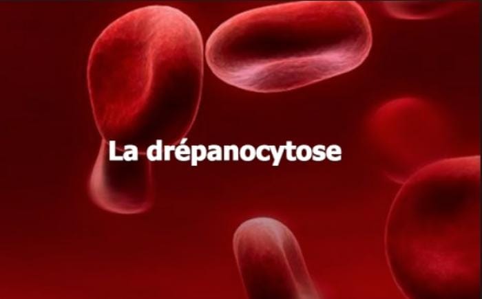 Traitement Naturel de la Drépanocytose