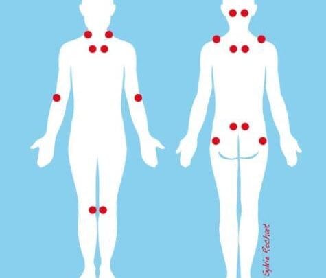 Soulager Naturellement la Fibromyalgie