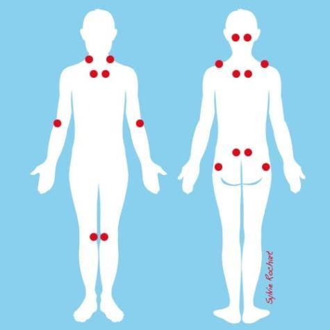 Soulager Naturellement la Fibromyalgie