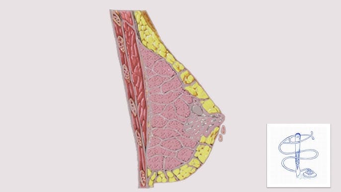 Galactorrhée Solutions Naturelles