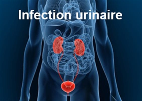 Infections Urinaires Solutions Naturelles