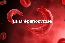 Traitement Drépanocytose