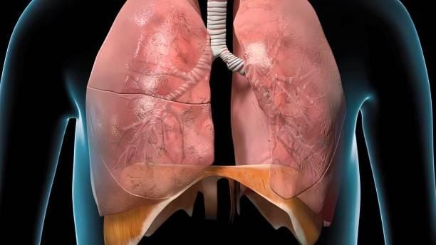 Fibrose Pulmonaire Solution Naturelle