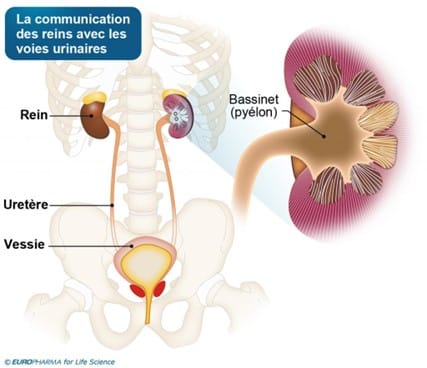 Pyélonéphrite et Néphrite Traitement Naturel