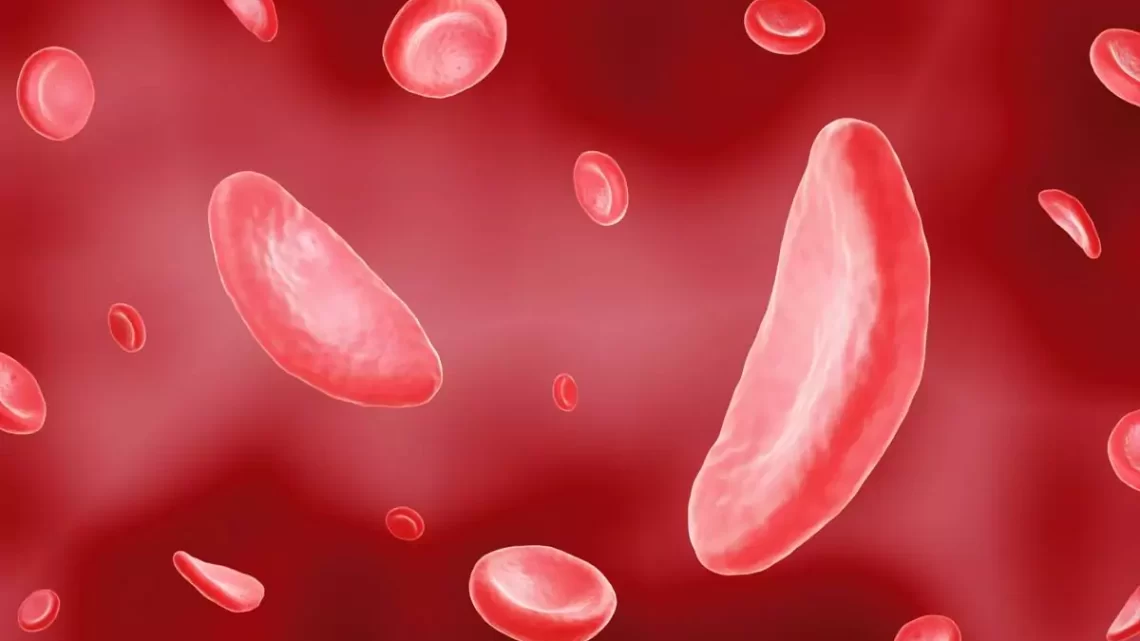 Drépanocytose SS Remède Naturel