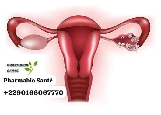 Infertilité féminine causes traitements naturels