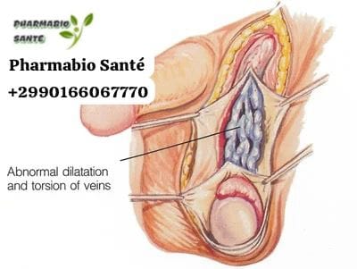 Soin Bio Varicocèle Testiculaire