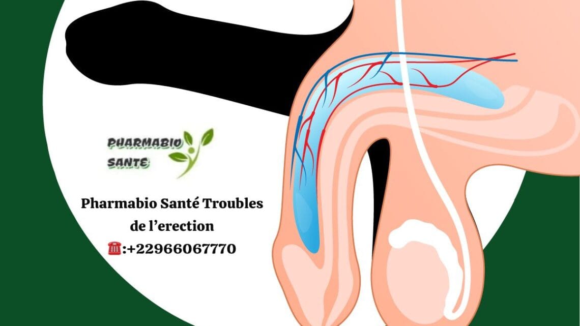 Troubles de l'Érection Traitements Efficaces