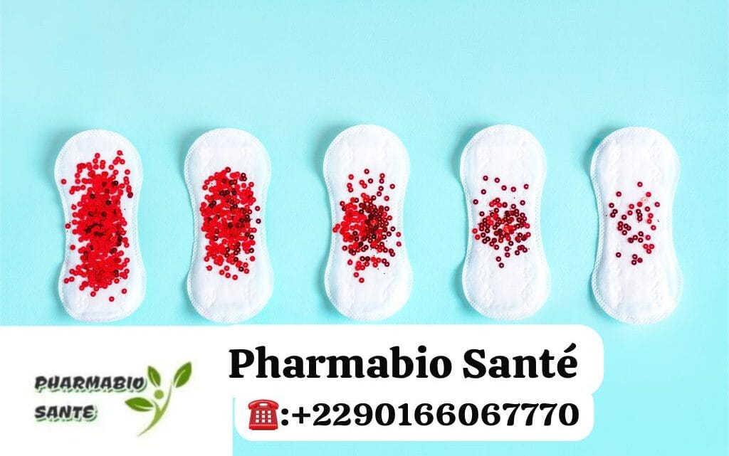 Règles Abondantes Traitement Naturel