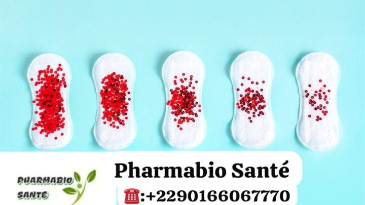 Règles Abondantes Traitement Naturel