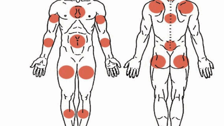 Fibromyalgie Solutions Naturelles