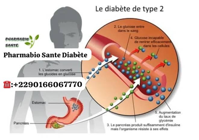 Diabète de Type 2 Remèdes Naturels