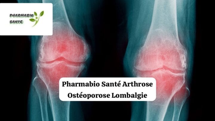 Traitement Naturel de l’Arthrose