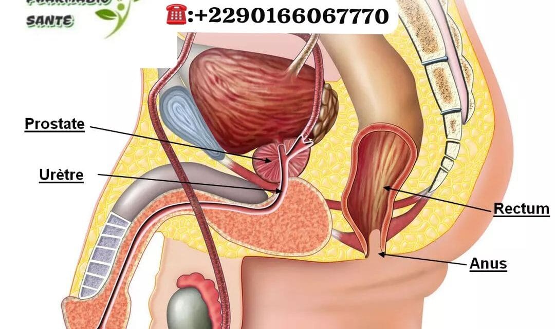 Santé Prostate Remède Naturel