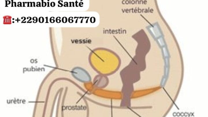 Douleurs Pelviennes Traitements Naturels