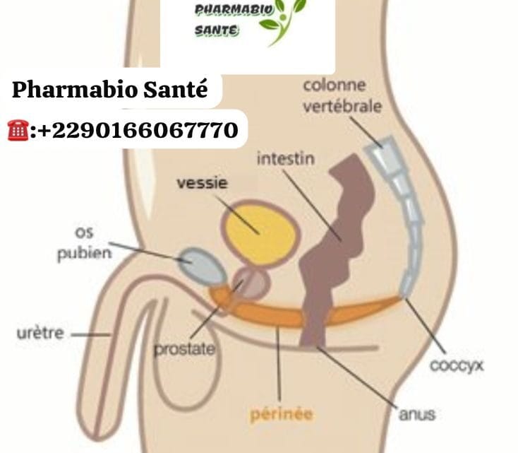 Douleurs Pelviennes Traitements Naturels