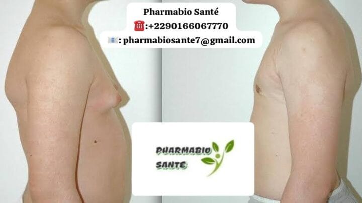 Gynécomastie et Alimentation