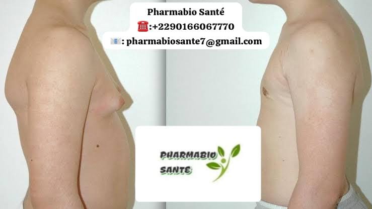 Gynécomastie et Alimentation