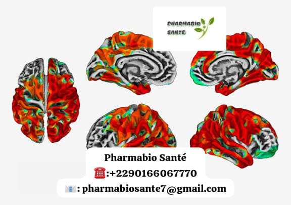 Parkinson sommeil traitement naturel