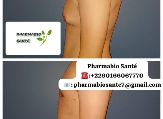 Gynécomastie et Musculation