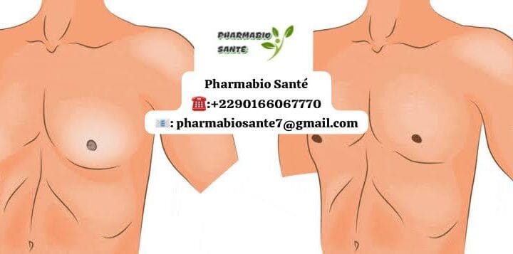 Gynécomastie ou Graisse