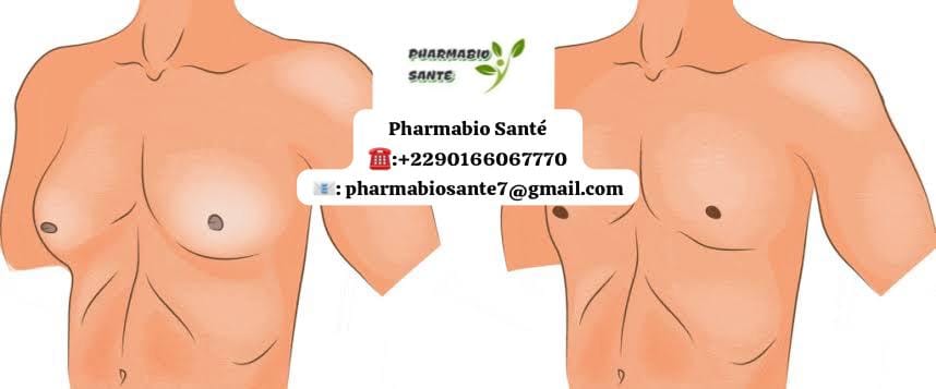 Gynécomastie ou Graisse