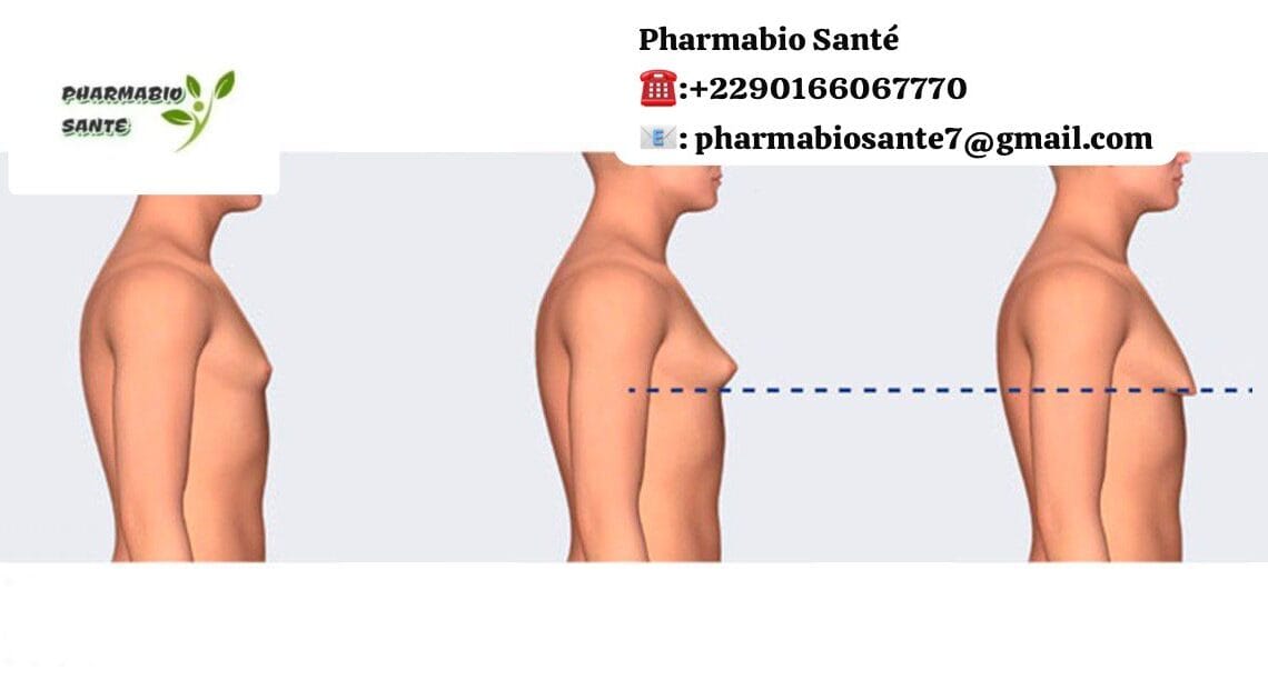 Remède de Grand-Mère pour Gynécomastie
