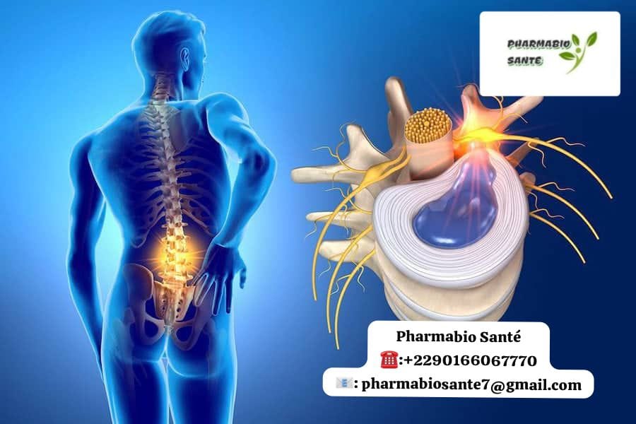 Plantes hernie discale