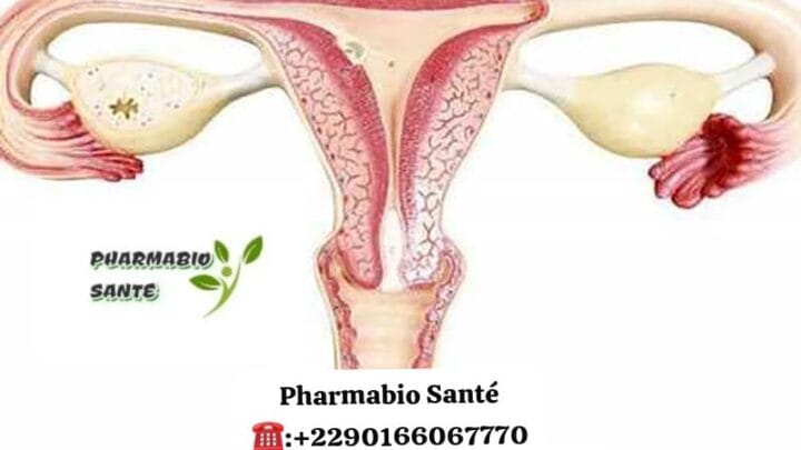 Santé trompes de Fallope naturelles