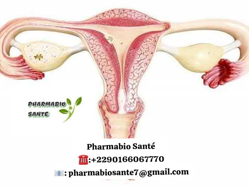 Santé trompes de Fallope naturelles