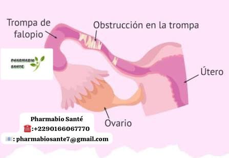 Déboucher trompes de Fallope possible