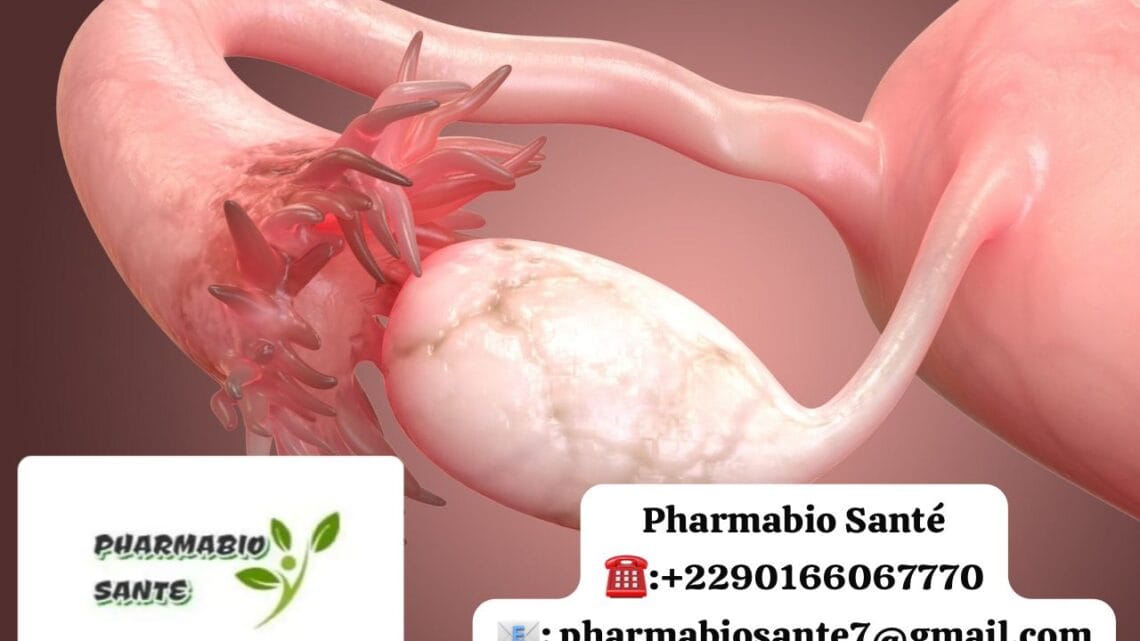 Savoir si trompes bouchées