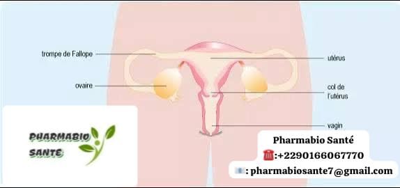 Salpingite Infection des Trompes