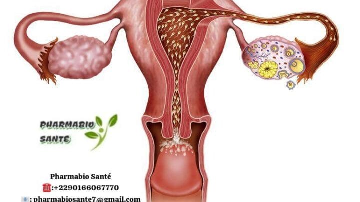 Plantes pour trompes bouchées