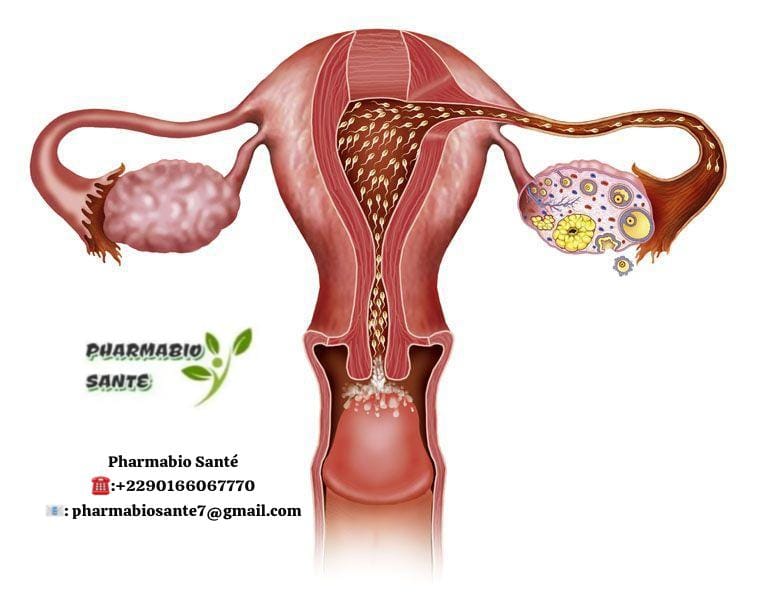 Plantes pour trompes bouchées