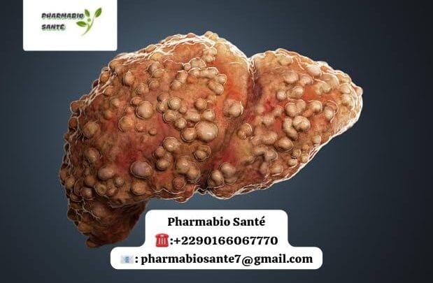 Guérir du Foie Gras