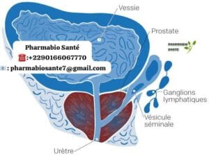 Comment soigner une prostatite naturellement