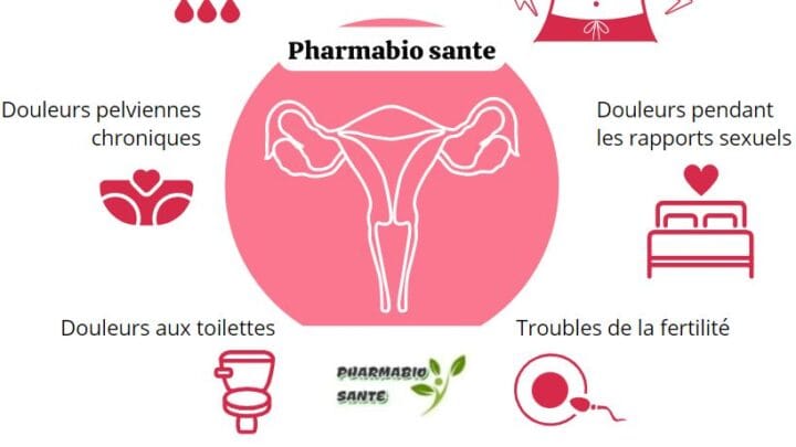 Soigner l'Endométriose par les Plantes
