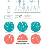 Aspermie causes traitements Naturels