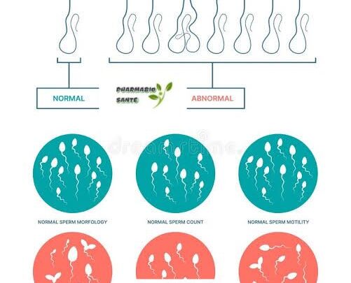 Aspermie causes traitements Naturels