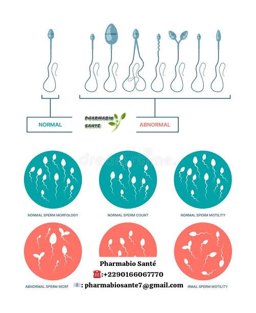 Aspermie causes traitements Naturels