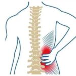 Soulager un lumbago naturellement